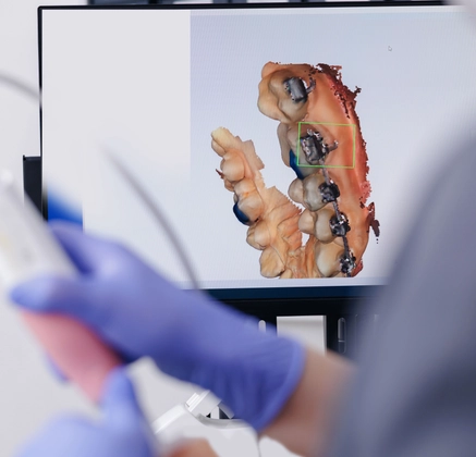 Dental Imaging
