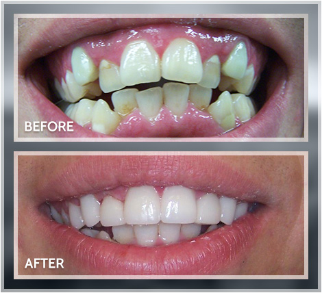 Smile transformation result 1