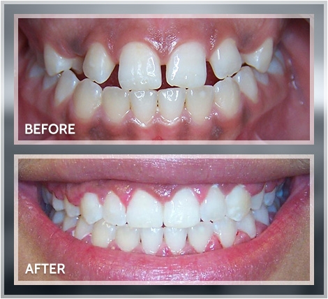 Smile transformation result 2