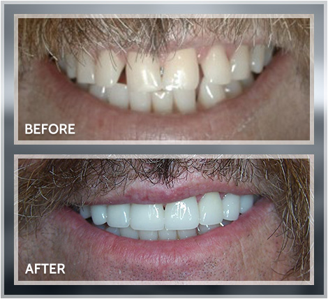Smile transformation result 3